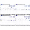 Cable Mmcx to RPSMA/ACMMCXRPSMA Mikrotik