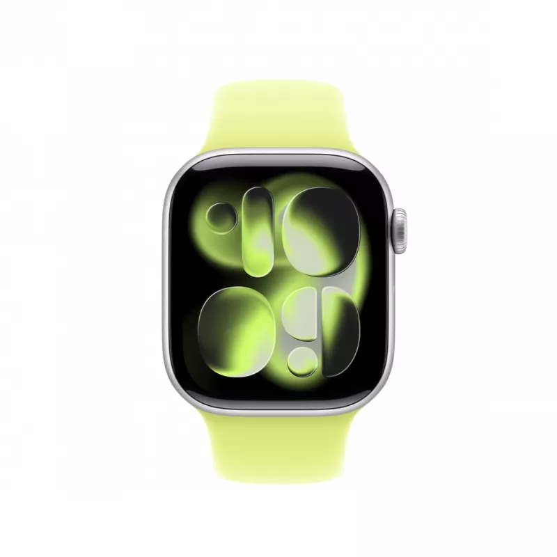 Band Apple MFGC4ZM/A Yellow Fluoroelastomer 130-180 mm