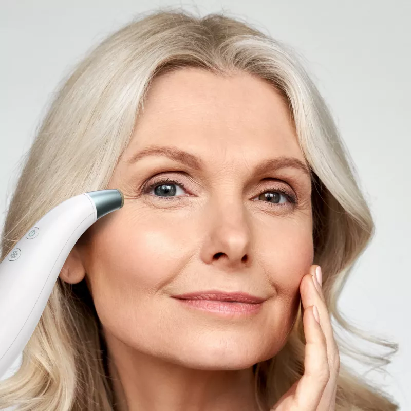 HoMedics MD-1000-EU2 skin care appliance Skin vacuum microdermabrasion White