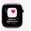 Smartwatch Apple Watch Series 11 GPS + Cellular 46mm Titanium Case