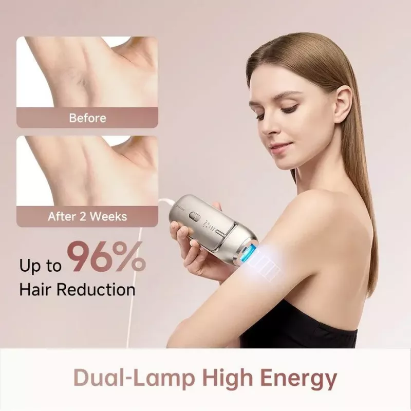 Dreame AHR01-GOLD IPL Hair Removal Device Nova Gold with 990,000 Flashes, 5 Energy Levels, UV Filter, Corded
